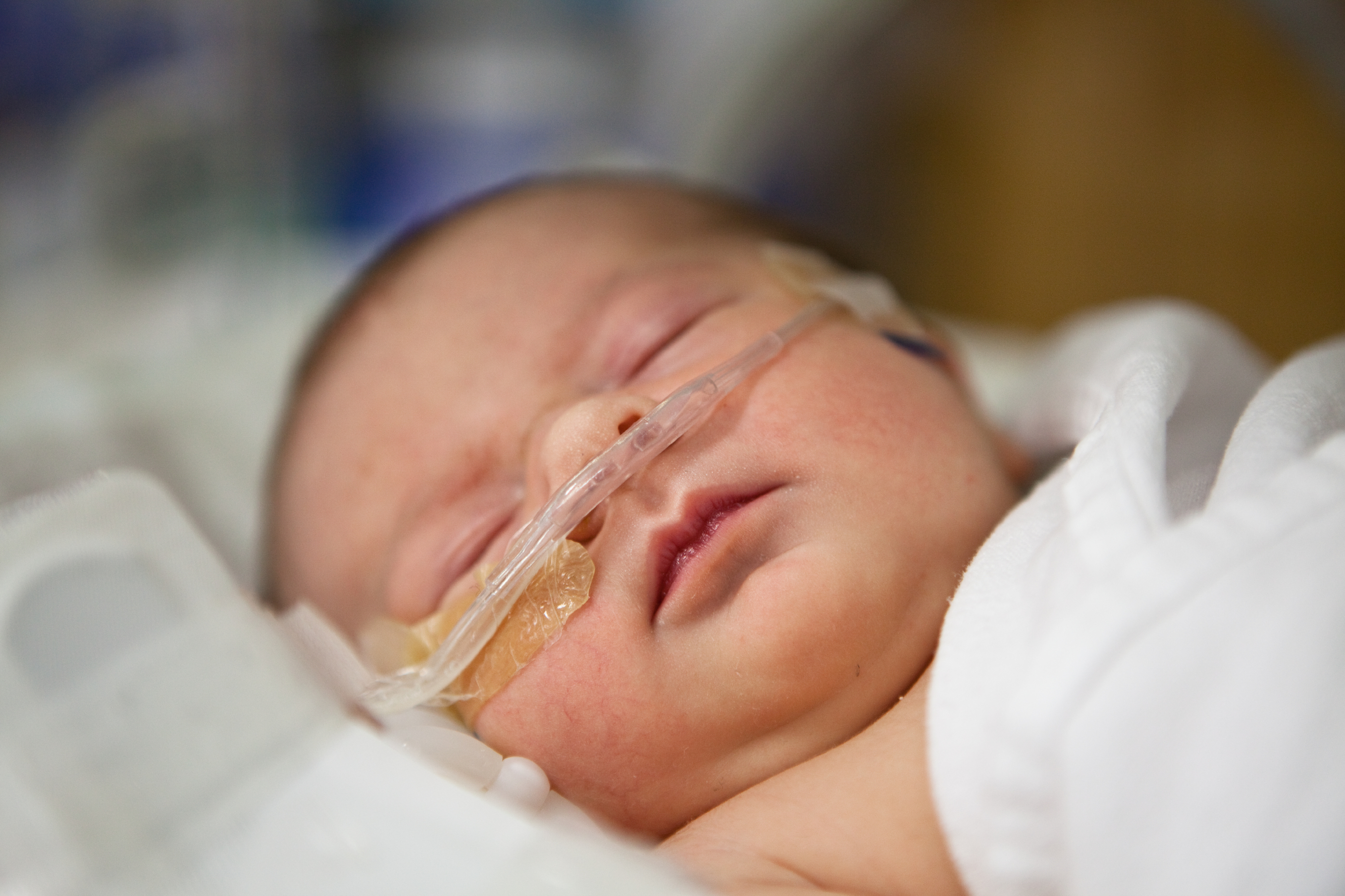 Image of infant in NICU